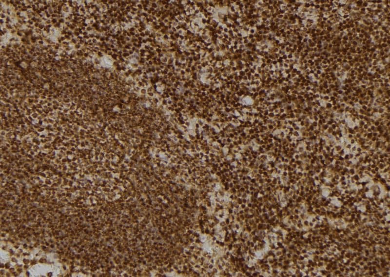 p58 / PSMD3 Antibody