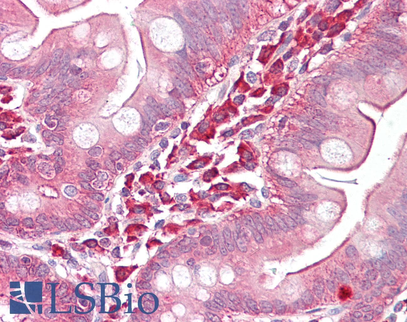 IHC-plus™ EZR / Ezrin Antibody (aa511-560)