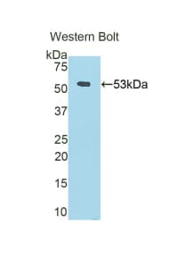 Polyclonal Rabbit anti-Human FGB / Fibrinogen Beta Chain Antibody (FITC, aa45-491, WB)