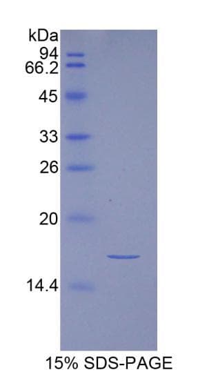 Human INHA / Inhibin Alpha Protein (Recombinant His)