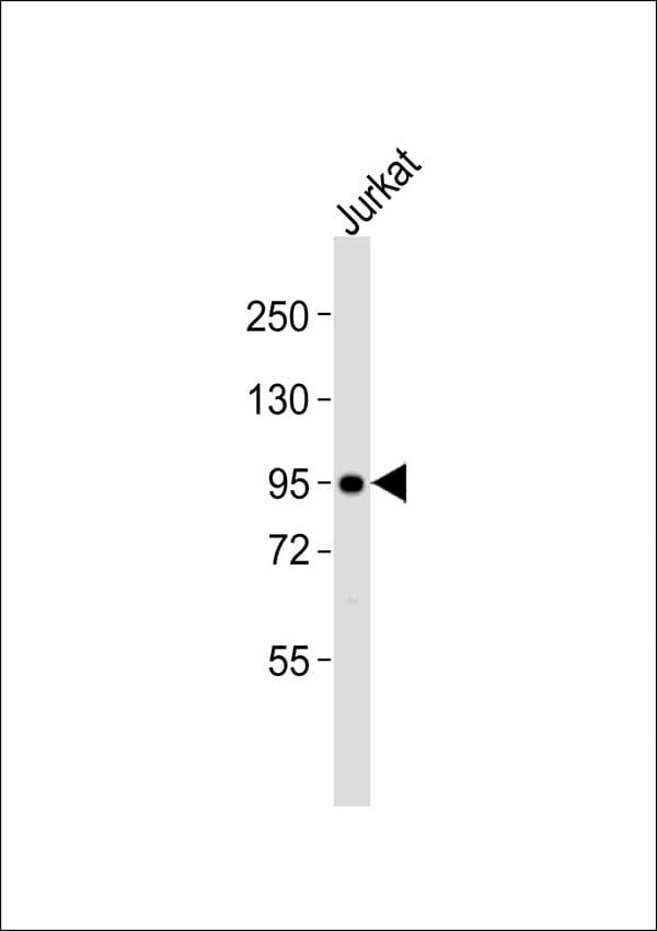 Polyclonal Rabbit anti-Human AKAP8 / AKAP95 Antibody (WB)