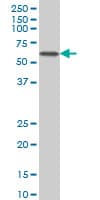 IHC-plus™ CACNB2 Antibody (clone 6C1)