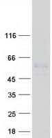 Human MMP3 Protein (Recombinant Myc-DDK (Flag))