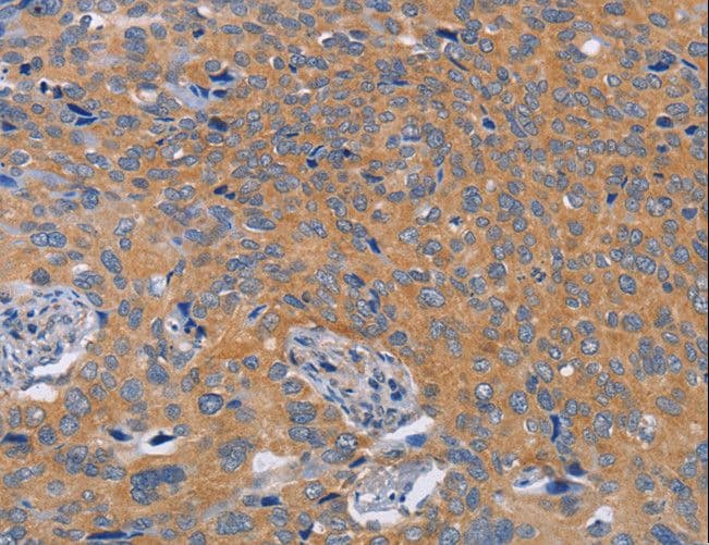 Polyclonal Rabbit anti-Human BOD1 Antibody (IHC)