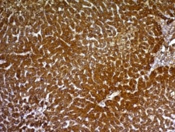 PathPlus™ Hepatocyte Specific Antigen Antibody (clone HepPar1)