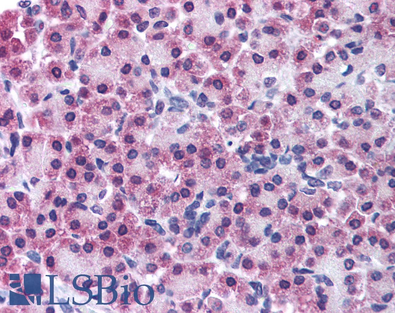 IHC-plus™ Polyclonal Rabbit anti-Human TSAP6 / STEAP3 Antibody (IHC, IF, WB)