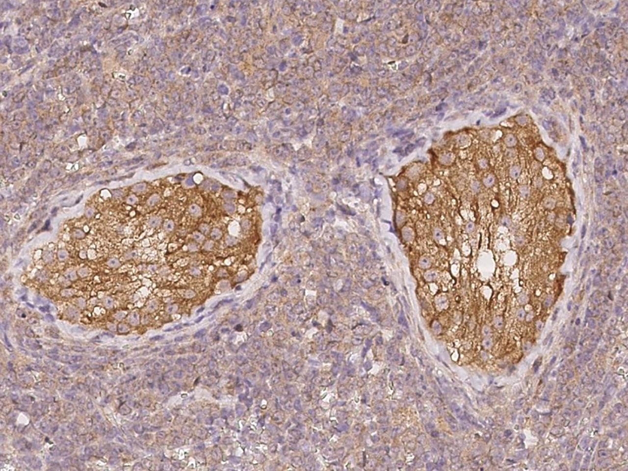 Polyclonal Rabbit anti-Human ADAM20 Antibody (IHC)