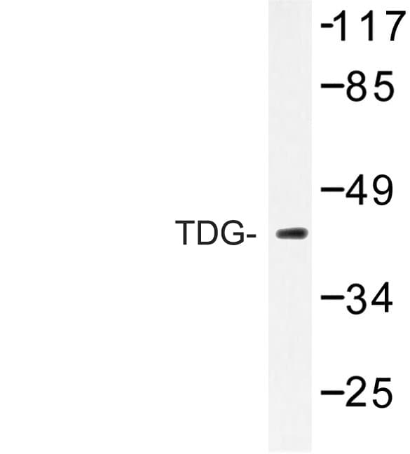 TDG / Thymine DNA Glycosylase Antibody (Lys90)