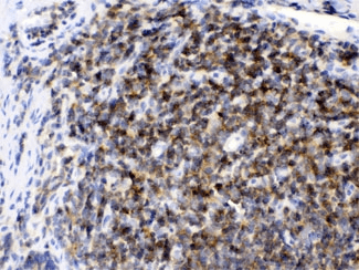 ARHGEF1 Antibody