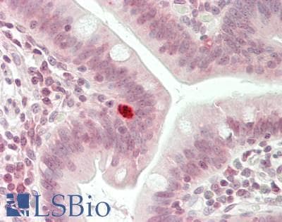 IHC-plus™ Polyclonal Rabbit anti-Human c-Maf Antibody (aa301-350, IHC, WB)