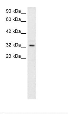 Polyclonal Rabbit anti-Human TAL1 Antibody (C-Terminus, IHC, WB)