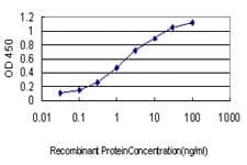 IHC-plus™ Monoclonal Mouse anti-Human RRM2 Antibody (clone 1E1, IHC, IF, WB)