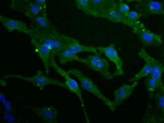 SCARB1 / SR-BI Antibody (Biotin)