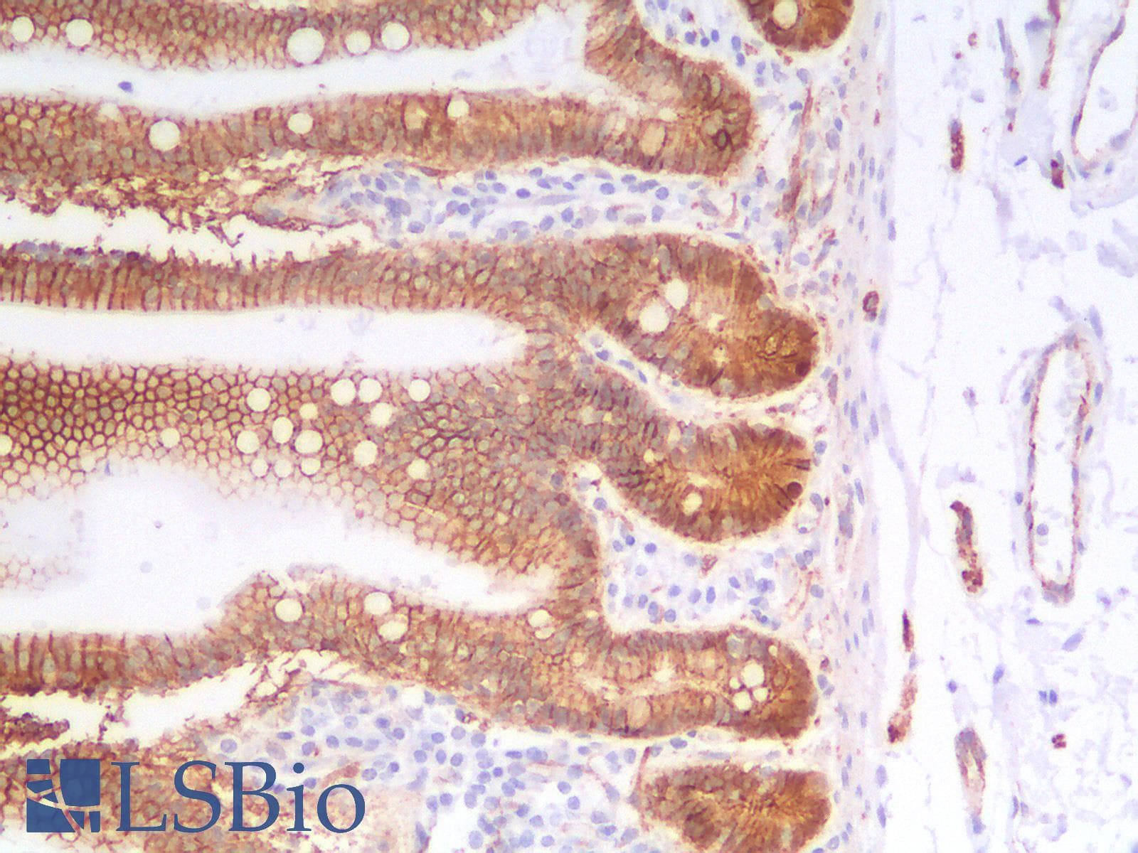 PathPlus™ CTNNB1 / Beta Catenin Antibody (clone CTNNB1/2030R)