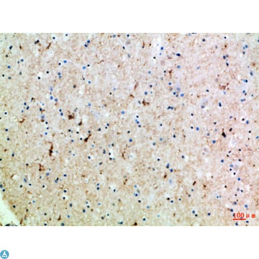 SLC6A1 / GAT-1 Antibody