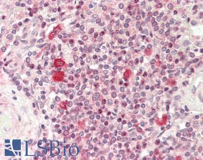 Polyclonal Rabbit anti-Human FKBP4 / FKBP52 Antibody (aa440-459, IHC, WB)