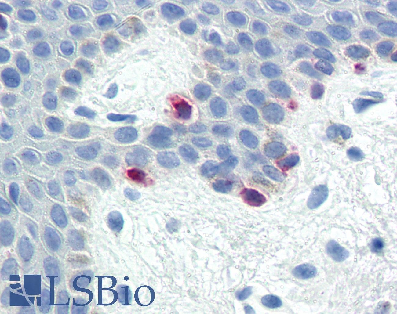 PathPlus™ MLANA / Melan-A Antibody (C-Terminus)