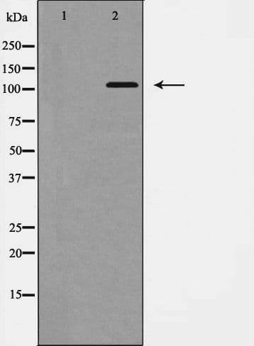EPHB1 / EPH Receptor B1 Antibody