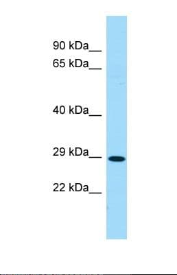SLC35D1 Antibody (aa179-227)