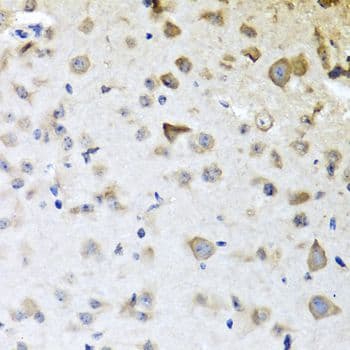 CPA6 / Carboxypeptidase A6 Antibody
