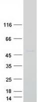 Human LASS4 Protein (Recombinant Myc-DDK (Flag))