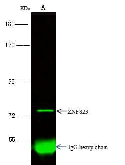 Polyclonal Rabbit anti-Human ZNF823 Antibody (Preservative Free, WB)