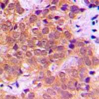 RELA / NFKB p65 Antibody (phospho-Ser468)