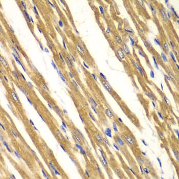 SOD2 / Mn SOD Antibody