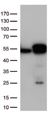 Monoclonal Mouse anti-Human CALR / Calreticulin Antibody (clone OTI13E4, WB)