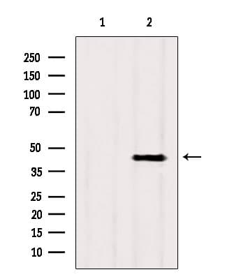 Polyclonal Rabbit anti-Human SCAD / ACADS Antibody (IHC, WB)