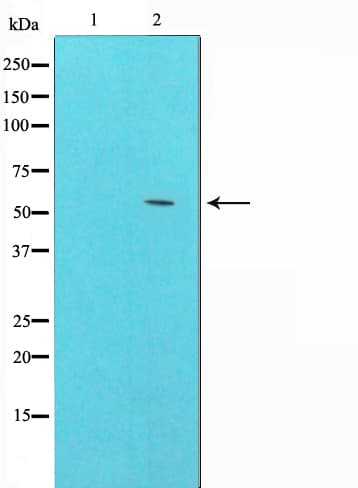 GSK3A / GSK3 Alpha Antibody (phospho-Ser21)
