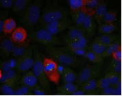 Polyclonal Rabbit anti-Human RELA / NFKB p65 Antibody (IHC, IF, WB)