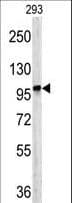 Polyclonal Rabbit anti-Human Dipeptidylpeptidase 8 / DPP8 Antibody (aa846-876, IHC, WB)
