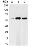 Polyclonal Rabbit anti-Human CHEK1 / CHK1 Antibody (phospho-Ser317, IHC, WB)