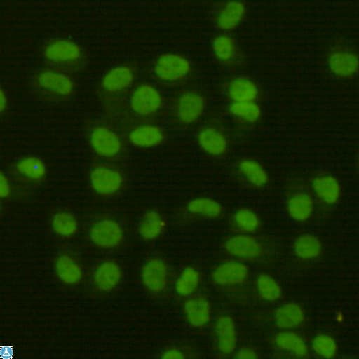FEN1 Antibody