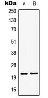 Polyclonal Rabbit anti-Human GSCL / GSC2 Antibody (C-Terminus, WB)