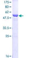 Human TPI1 / TPI Protein (Recombinant GST)