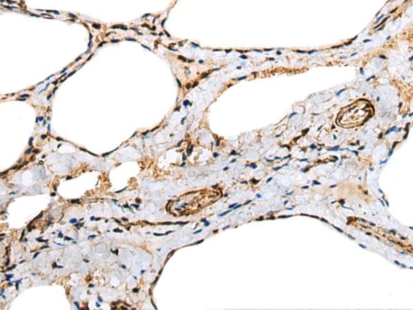 TNNC1 / Cardiac Troponin C Antibody