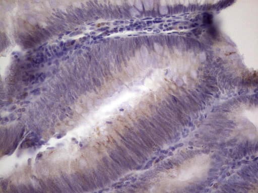 PAGE1 Antibody (clone OTI3E7)