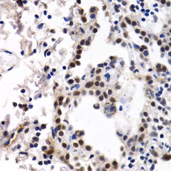 Polyclonal Rabbit anti-Human ID3 Antibody (IHC, IF, WB)