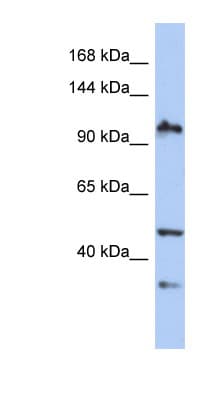 Polyclonal Rabbit anti-Human XAB2 Antibody (aa35-84, WB)