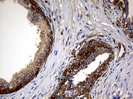 Monoclonal Mouse anti-Human NME1 / NM23 Antibody (clone OTI7F2, IHC, WB)