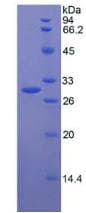 Human DDAH2 Protein (Recombinant His-T7)