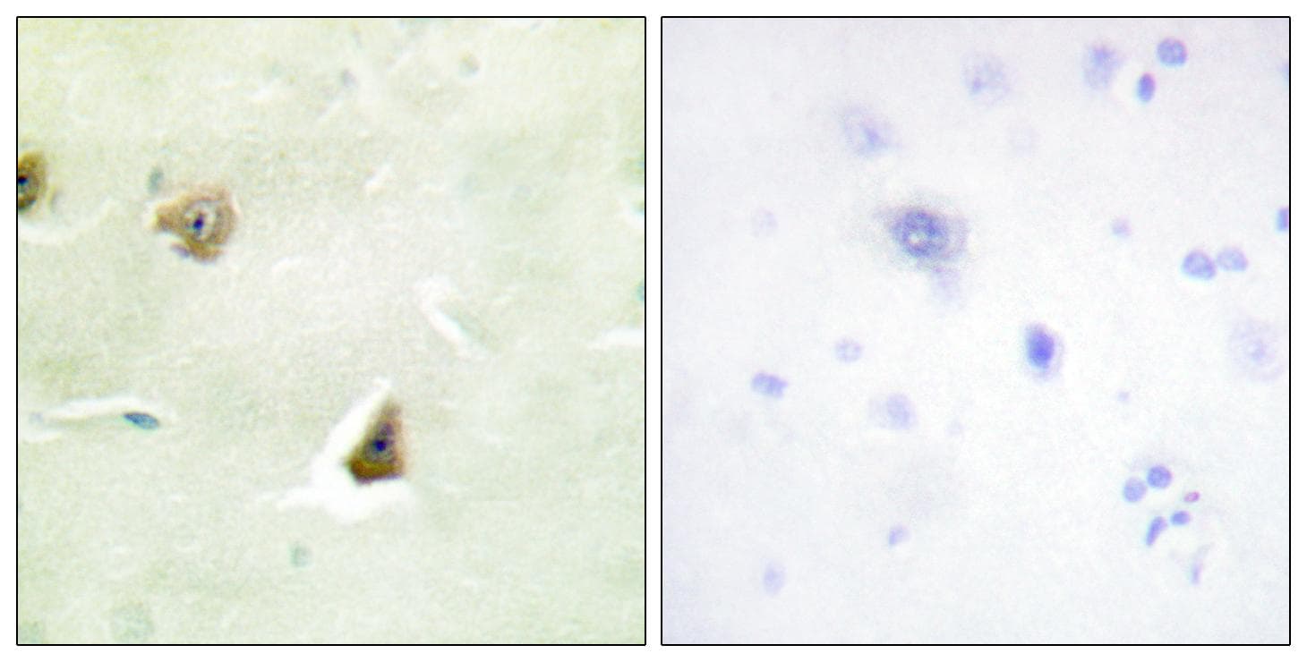 DUSP6 / MKP3 Antibody