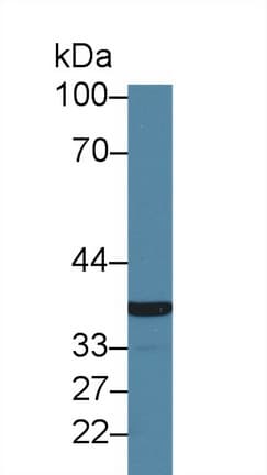 GP6 / GPVI Antibody (aa86-231)