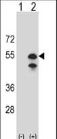 CPN1 Antibody (aa52-81)