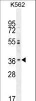 Polyclonal Rabbit anti-Human OR2M3 Antibody (aa244-272, WB)
