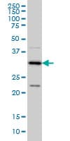 MED27 / CRSP8 Antibody (clone 8B8)