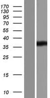 HADH Protein (Over-Expression Lysate Myc-DDK (Flag))