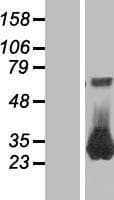 RAB26 Protein (Over-Expression Lysate Myc-DDK (Flag))